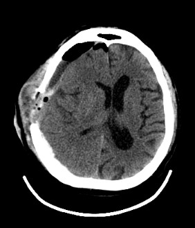 OmniTom-Adult Brain-3